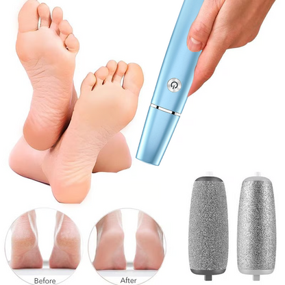 💥Zeitlich begrenztes Angebot 66 % RABATT🔥⚡Elektrischer Hornhautentferner für Füße
